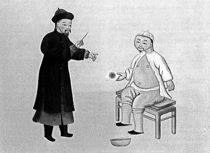 Ilustración china de la acupuntura